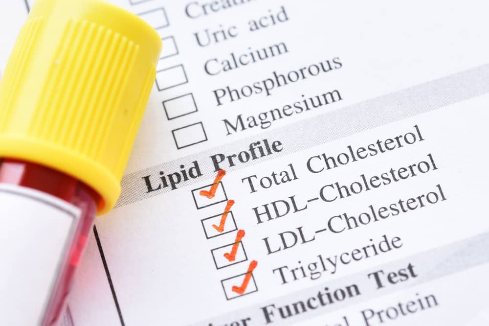 đọc kết quả xét nghiệm cholesterol và triglycerid