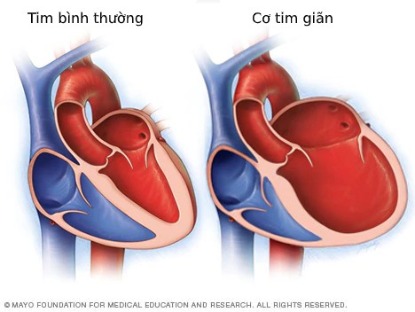 các bệnh liên quan đến tim