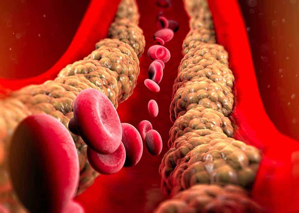 Cholesterol và Triglyceride là gì?